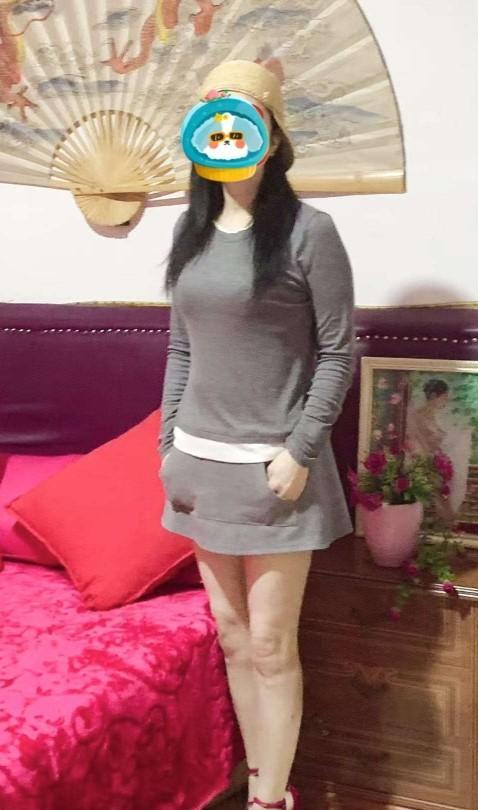 655113758|COLOMA|Chica
