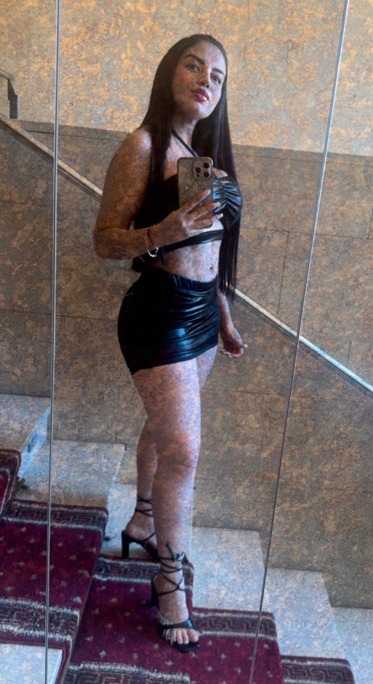 624398077|SOL|Chica